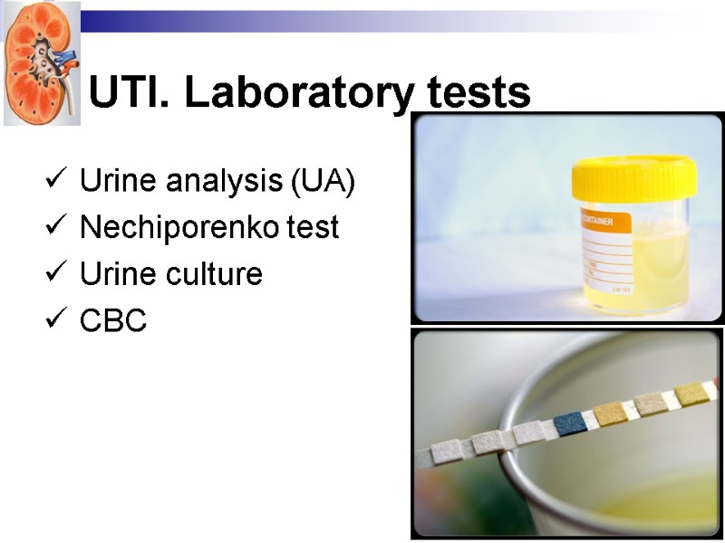 UTI. Laboratory tests  Urine analysis (UA)  Nechiporenko test Urine culture CBC
